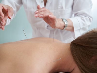 doctor-puts-needles-into-female-back-on-the-acupuncture-treatment-therapy-in-spa-salon-alternative